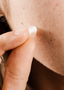 Pimple Patches